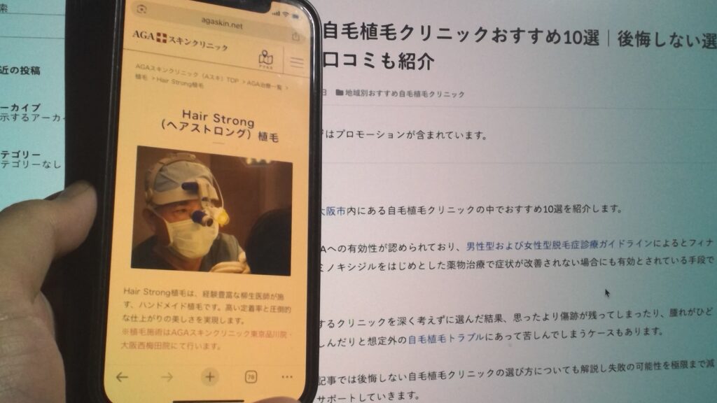 AGAスキンクリニック記事イメージ