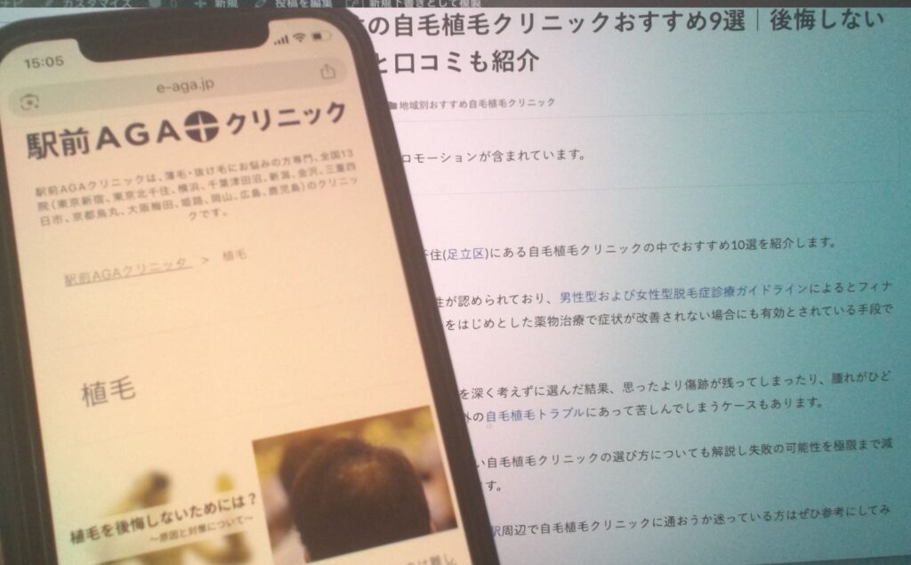 駅前AGAクリニックの記事イメージ