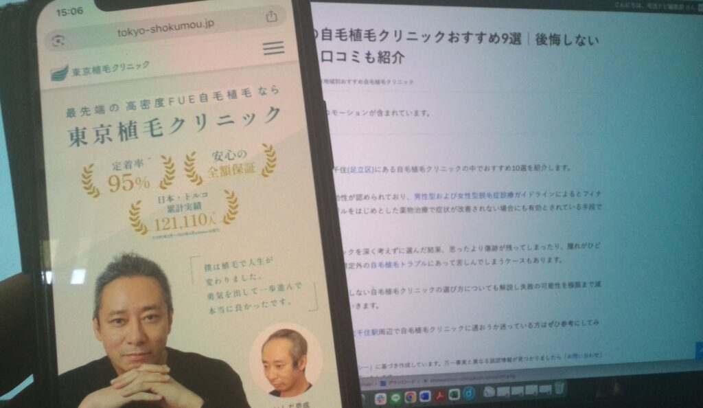 東京植毛クリニック記事イメージ
