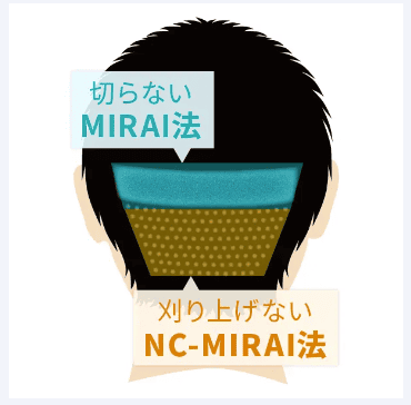 UNITED-MIRAI法のイメージ